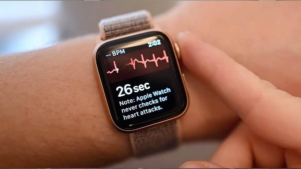 Apple Watch 可以充当可靠且准确的压力指示器