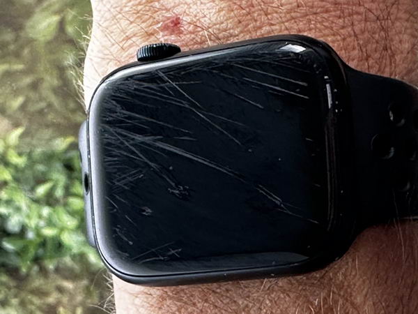苹果再次立功 - 老外亲身经历Apple Watch挽救了自己的生命插图2